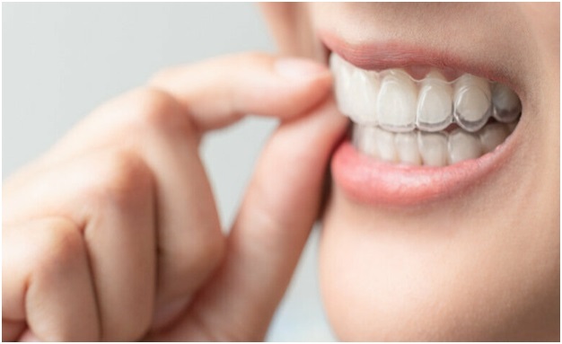 چرا ارتودنسی نامرئی سریعترین راه برای اصلاح دندان است؟