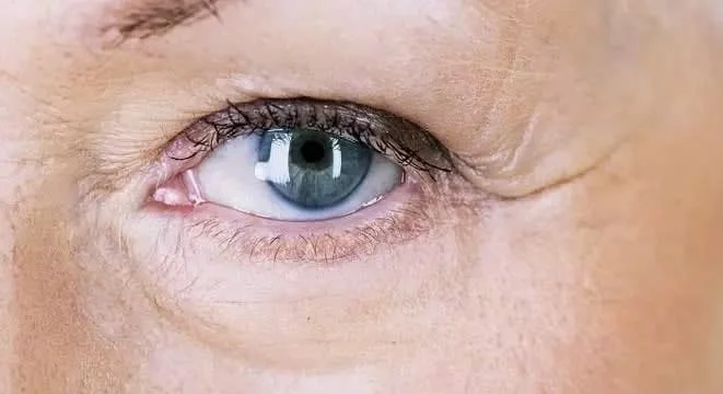 پوست