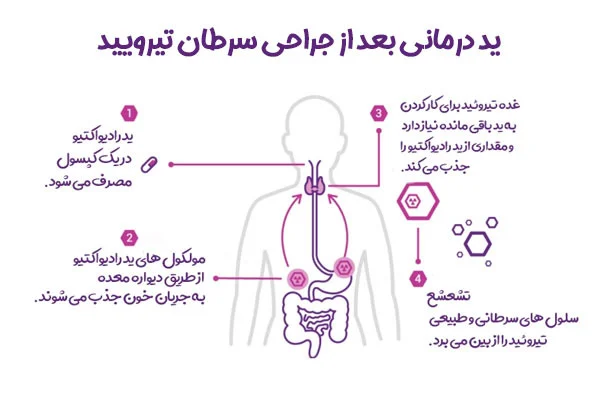 سرطان
