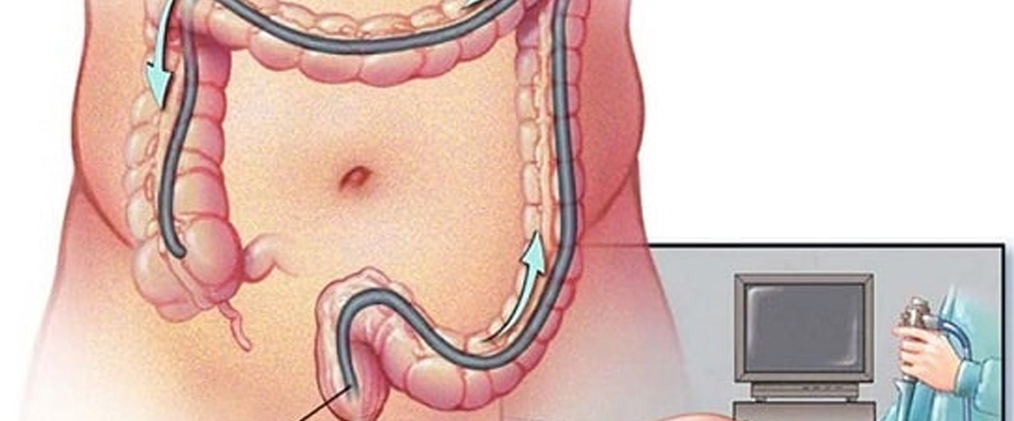 قیمت مناسب پکیج چکاپ
